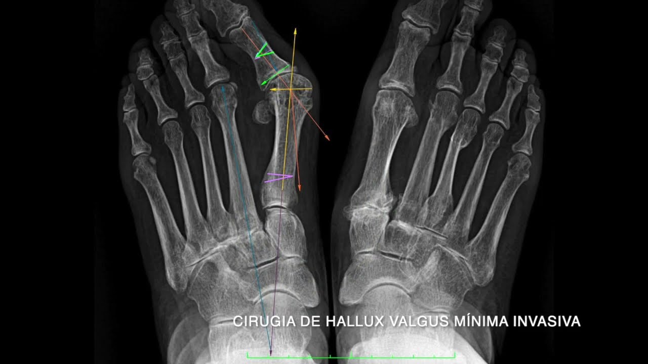 Marco Polo Malacón Gutiérrez-29