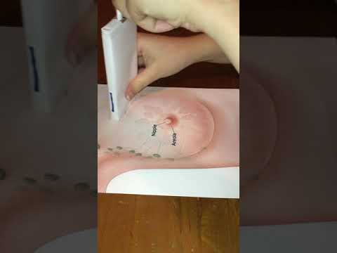 Radial and Anti Radial Breast Scanning Technique