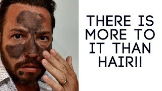 Hair replacement Men's Hair System Review There Is More To It Than Hair!