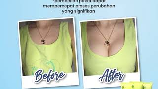 Download lagu PEMBESAR PAYUDARA CEPAT PERMANEN HALAL mp3