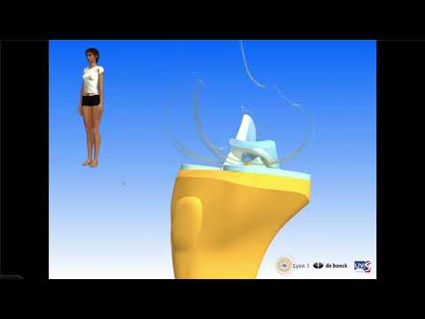 Le genou commenté : ménisques, ligaments croisés, ligaments latéraux, traumatologie des croisés