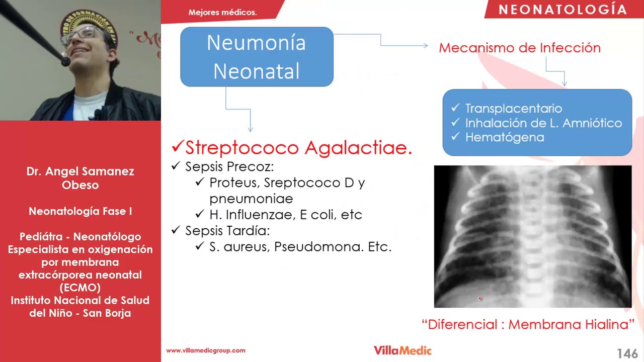 Neonatología 11: Neumonía neonatal