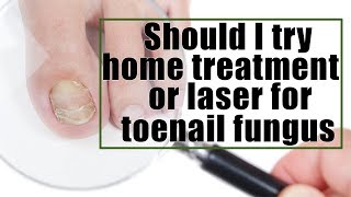 Should I try home treatment or laser for toenail fungus