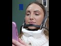 EVOKE Neck South Charleston WV | Non-Invasive Facial Treatment | Facial Tightening & Contouring