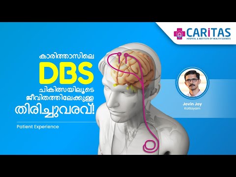 Back to life through DBS treatment at Caritas