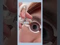 [YOPTICAL] super easy! MUST-HAVE for contact lens beginner