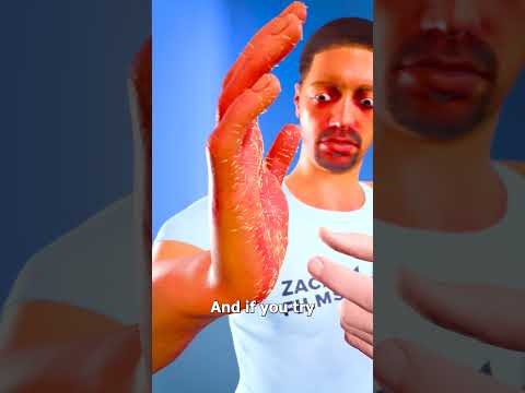 Why The Australian Stinging Tree Hurts So Much 😬