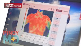 Download lagu 'Thermalytix,' puwedeng makapag-detect ng breast cancer sa mabilis at murang halaga! | Pinoy MD mp3 Download lagu 'Thermalytix,' puwedeng makapag-detect ng breast cancer sa mabilis at murang halaga! | Pinoy MD mp3