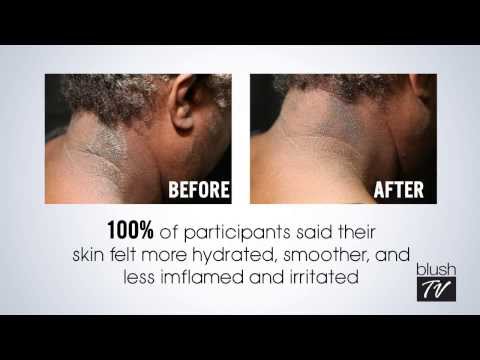 NEW Clinically Tested Relief for Your Eczema Symptoms is Here!