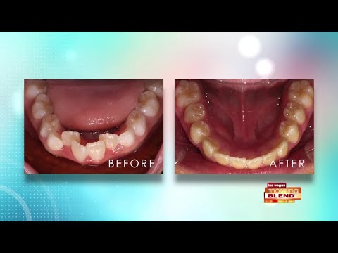 Pediatric Sleep Disordered Breathing and the Healthy Start Program