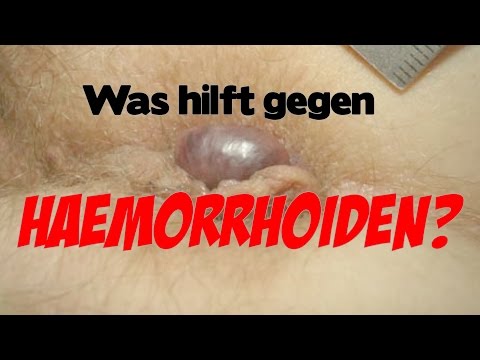 Wie die Schuppenflechte auf den sexuellen Lippen zu behandeln Mit der Schuppenflechte zu kämpfen