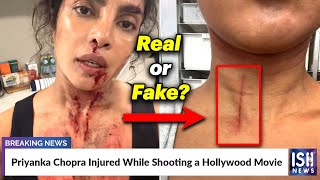 Priyanka Chopra Injured While Shooting a Hollywood Movie