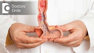 What causes buried penis & how is it surgically treated? - Dr. Srikanth V