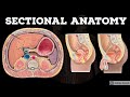 Sectional Anatomy Abdomen Pelvis Anatomy Decoded