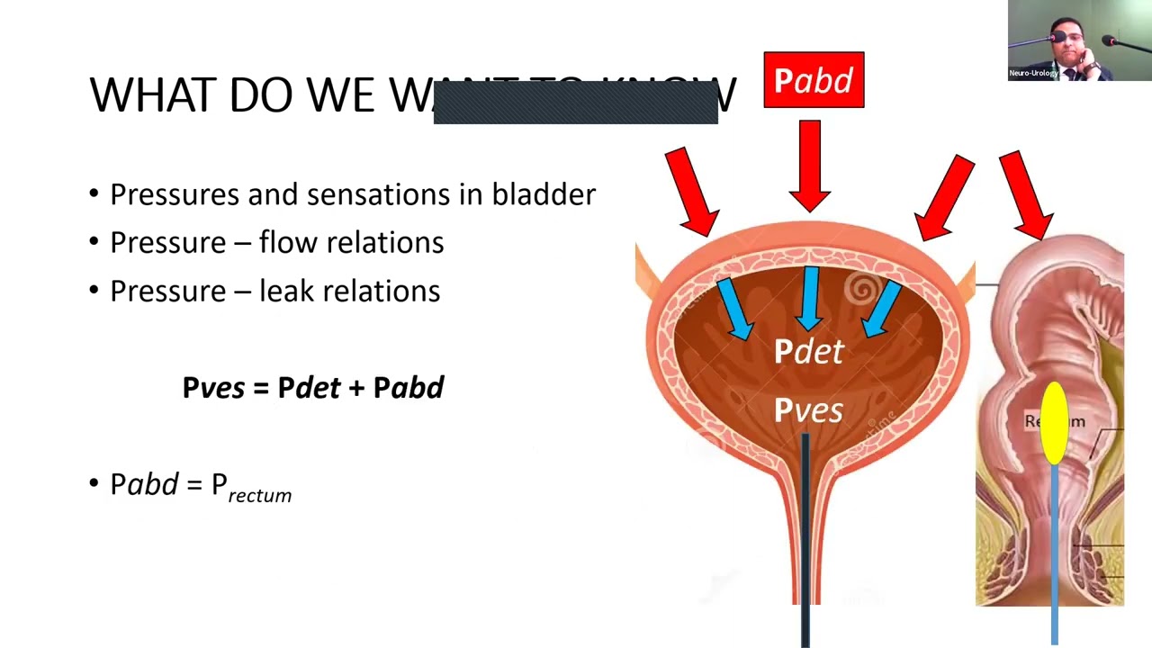 Urodynamics Setup by Dr Mayank Mohan Agarwal