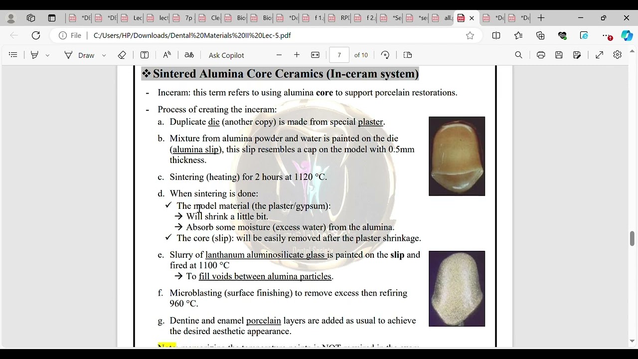 Dental Materials II Lec 5 pdf