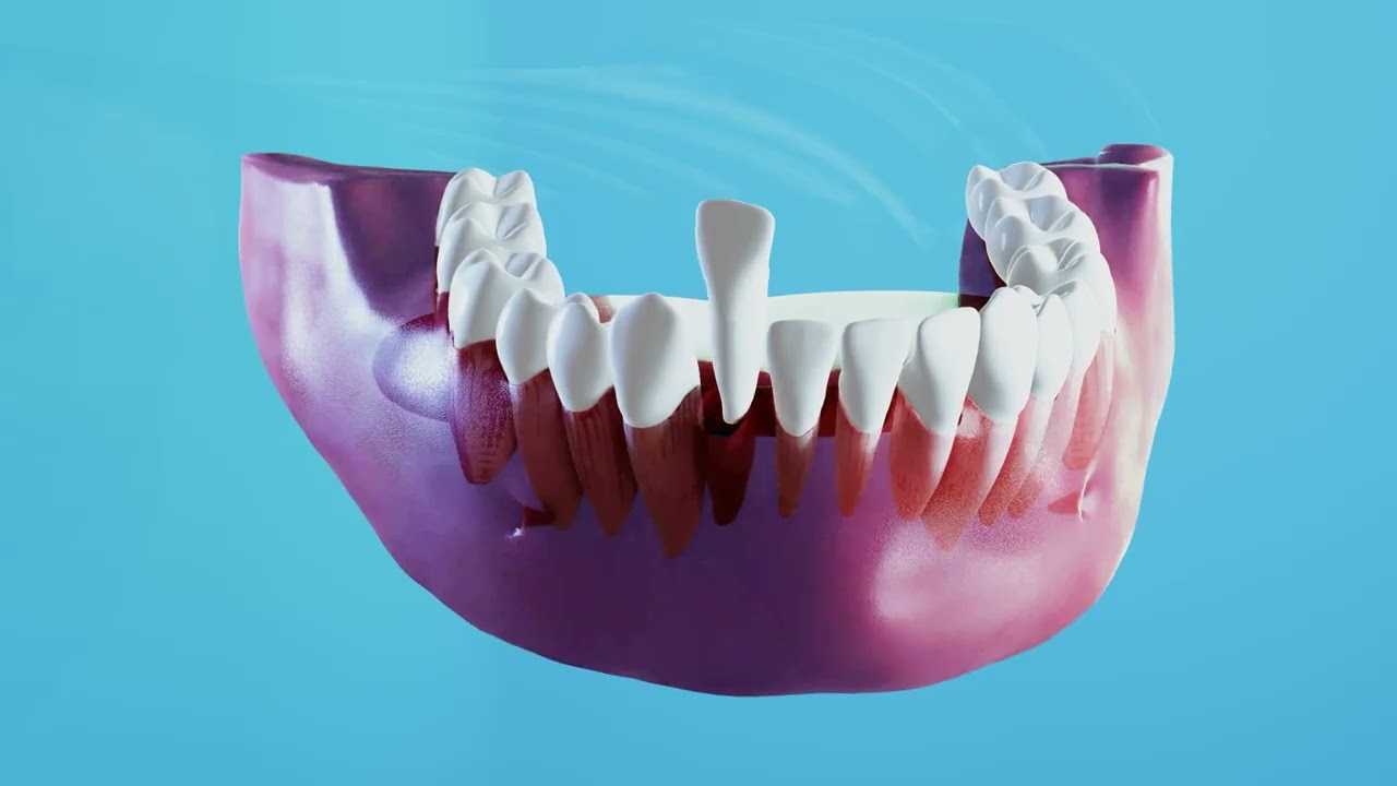 YouTube Thumbnail