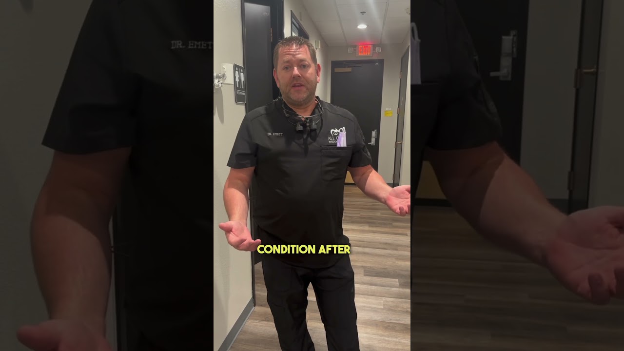 Dry Socket: by day 5-6 after your procedure, you are more than likely in the clear!