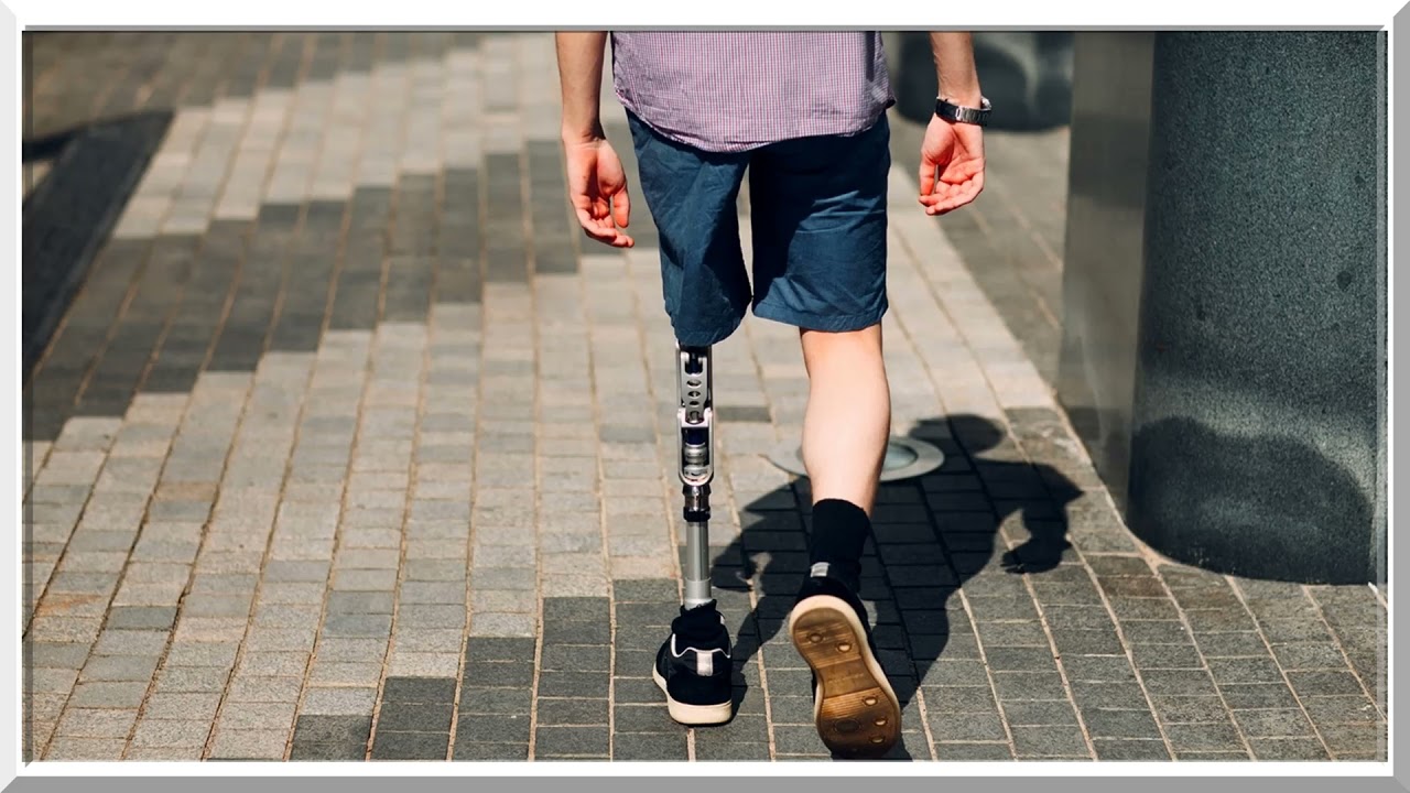 Rüyada Kesik Bacak Görmek