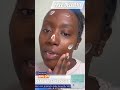 SAAM Melasma Cream Review From Our Customers Melasma Melasmacream Melasmatreatment Facecream