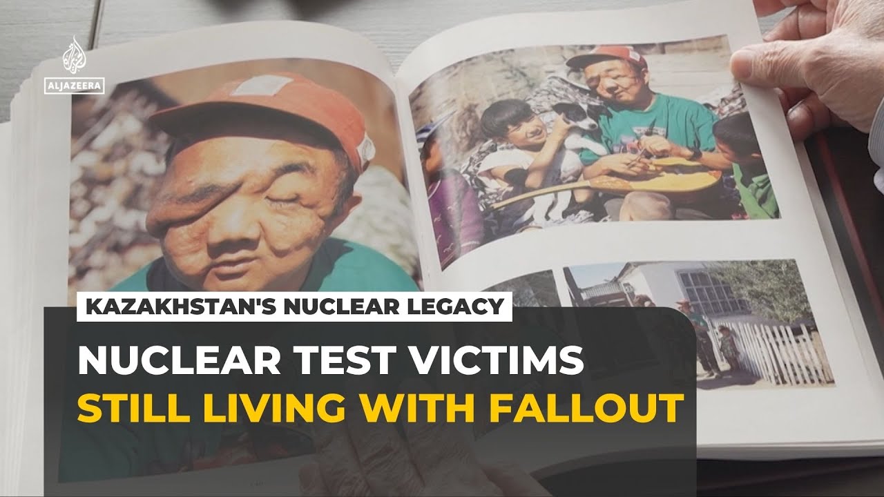 Kazakhstan’s nuclear test victims still battling radioactive fallout