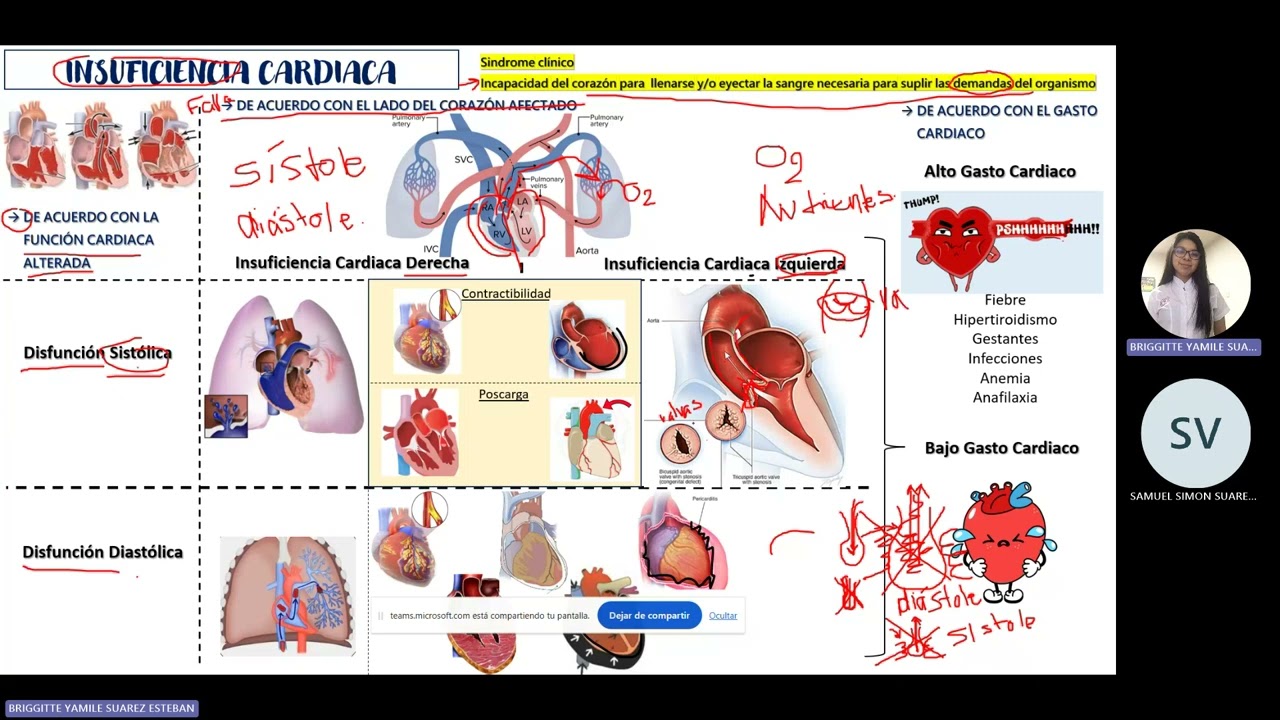 Fisiopatología - Insuficiencia cardiaca