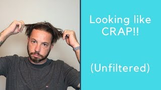 Hair Replacement Hair System Review Looking like CRAP! Unfiltered
