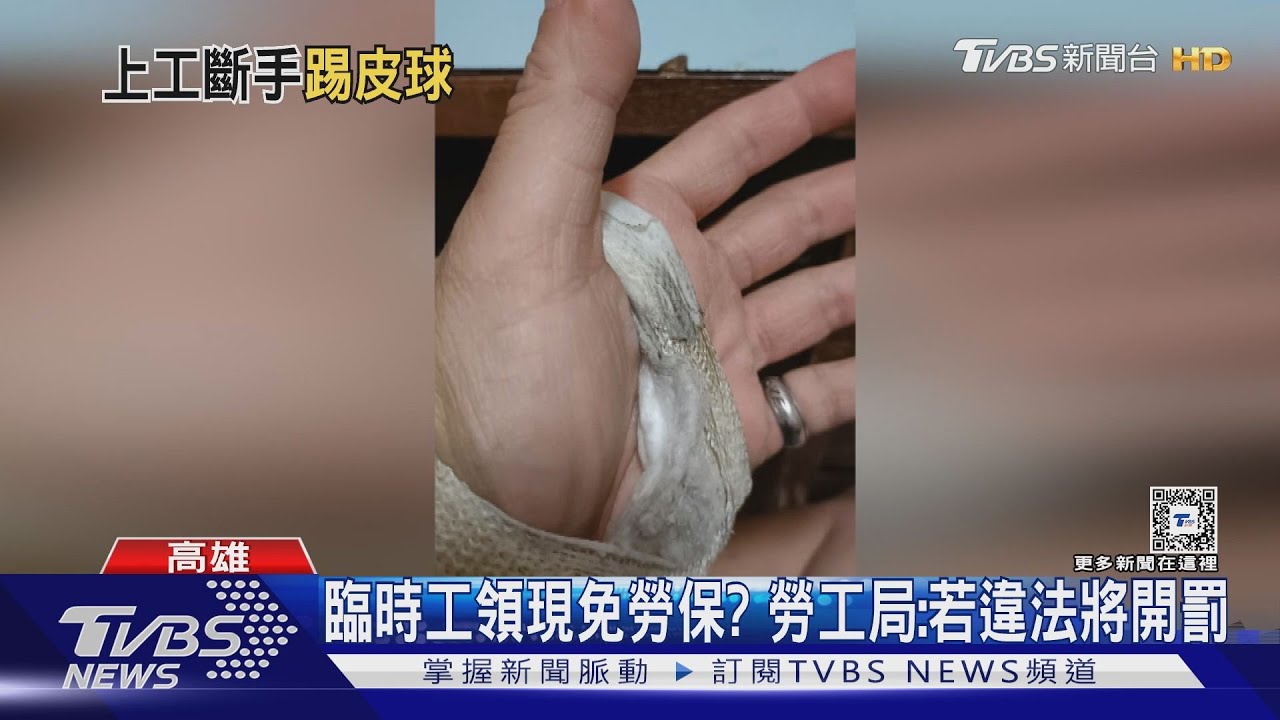 臨時工摔斷手!4個月無工作 控雇主沒勞保冷處理