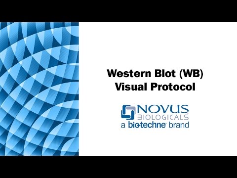 西方印跡(WB)可視化協議 (Western Blot (WB) Visual Protocol)