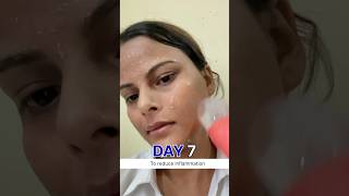 Download lagu 7day ice rubbing on face | Ice for face | face icing benefits #beautytips #ashortaday #skincare mp3 Download lagu 7day ice rubbing on face | Ice for face | face icing benefits #beautytips #ashortaday #skincare mp3