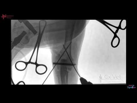 JPI DynaVue Fluoroscopy | External Elbow