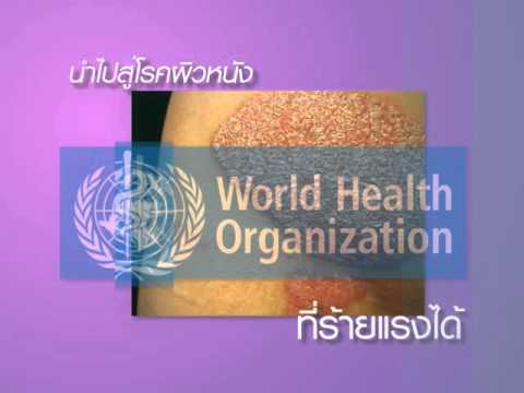 กลากและน้ำมันเบนซิน การรักษาโรคสะเก็ดเงิน 2016