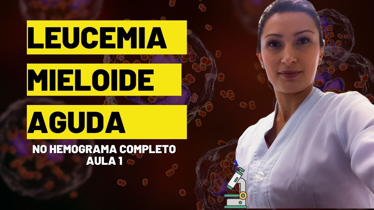 Como Identificar Leucemia Mieloide Aguda no hemograma completo #biomedicina #hematologia