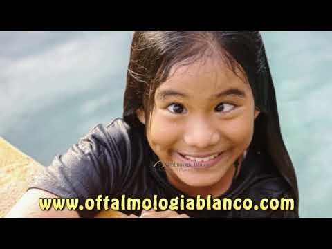 Estrabismo en los Niños