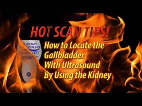 Hot Tip -  How to Locate the Gallbladder With Ultrasound