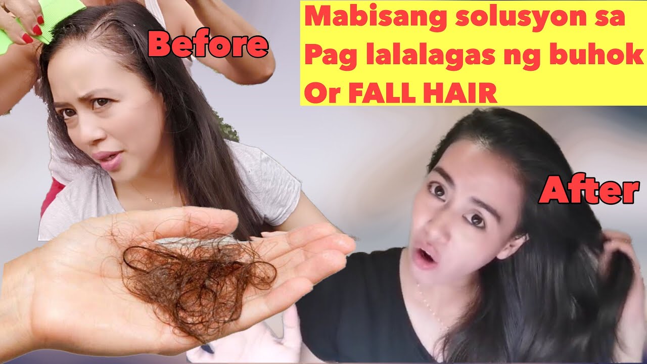 Putar video Mabisang gamot sa paglalagas at pampakapal na buhok |Buhok na nalalagas solusyon.. | Justmj garin sekarang Mabisang gamot sa paglalagas at pampakapal na buhok |Buhok na nalalagas solusyon.. | Justmj garin