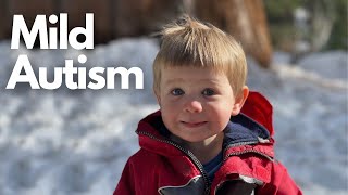 Diagnosis of Mild Autism in 2-year-old