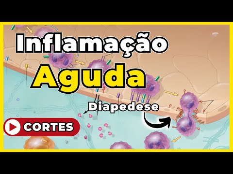 Inflamação Aguda - [Patologia Geral]