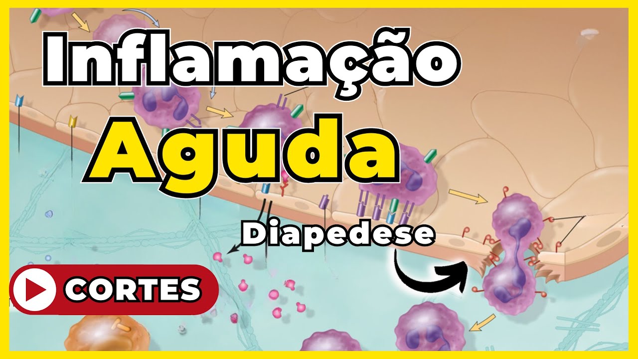 Inflamação Aguda - [Patologia Geral]