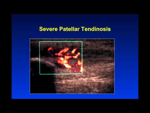 Introduction to Musculoskeletal Ultrasound