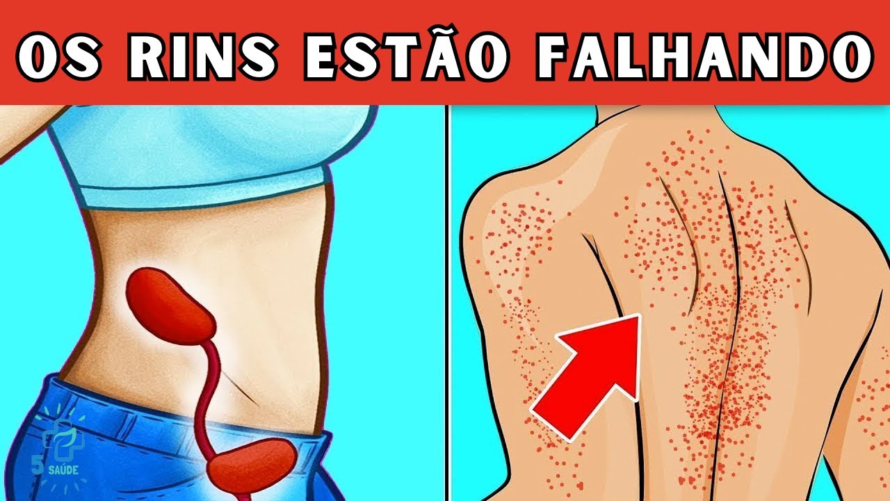 5 sinais de que seus rins estão pedindo ajuda