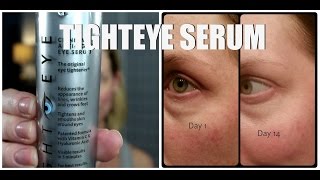 TIGHTEYE SERUM | Review | Before & After