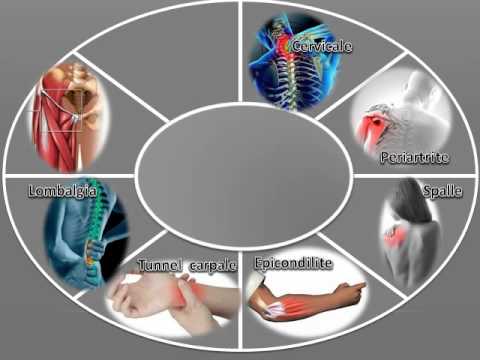 Lartrite reumatoide colpisce tutte le articolazioni Hip Foto Healthy