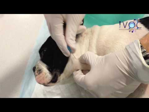 PUNCIÓN GANGLIO MANDIBULAR