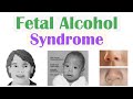 Fetal Alcohol Syndrome (FAS) | Risk Factors, Pathophysiology, Signs & Symptoms, Diagnosis, Treatment