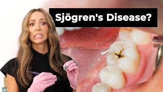 What If Your Cavities Aren't a Dental Problem?