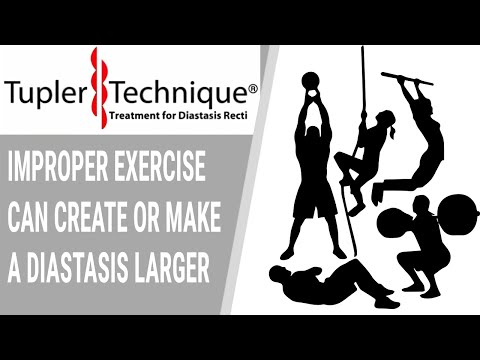 Improper Exercise Can Create or Make a Diastasis Larger-Julie Tupler, RN