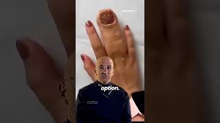 1:3000 Most Common Limb Malformation #shorts