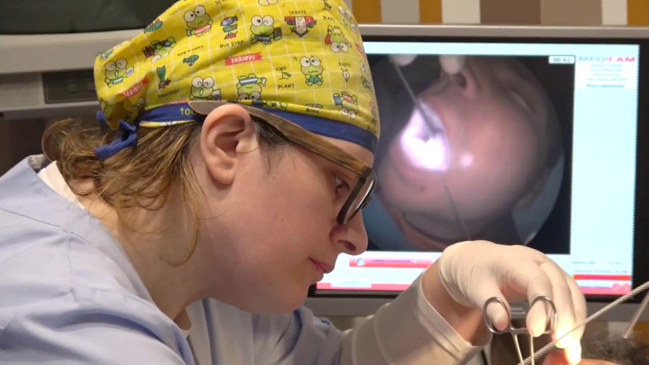 Trattamento laser per frenulo linguale corto