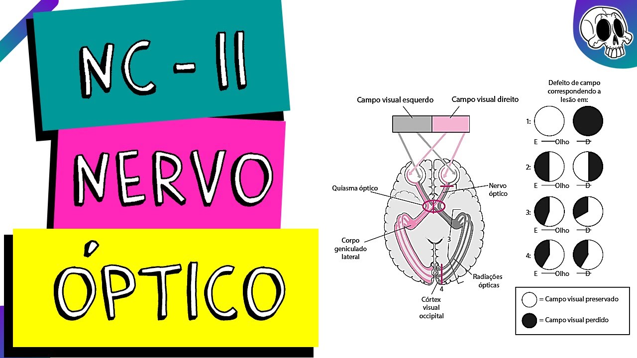 NERVO CRANIANO II - NERVO ÓPTICO | Lesão de QUIASMA ÓPTICO | Como Davi venceu Golias
